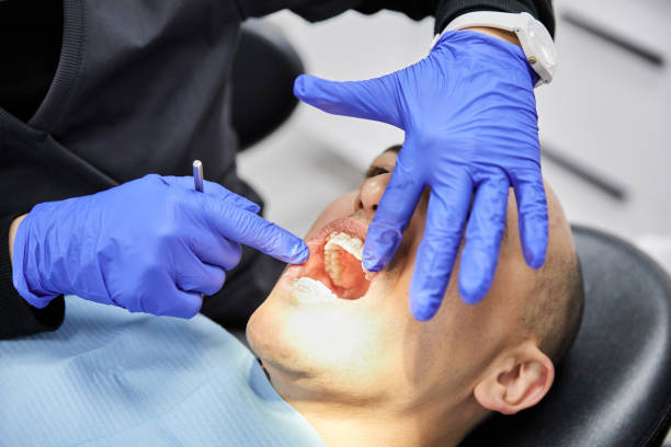 Best Emergency Wisdom Teeth Removal in Brewerton, NY